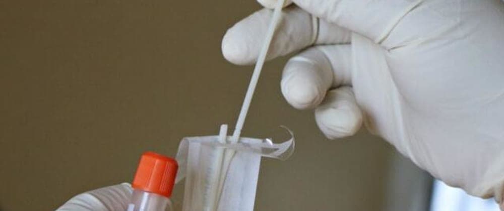 Preview image for How to test promises with Mocha. blog post